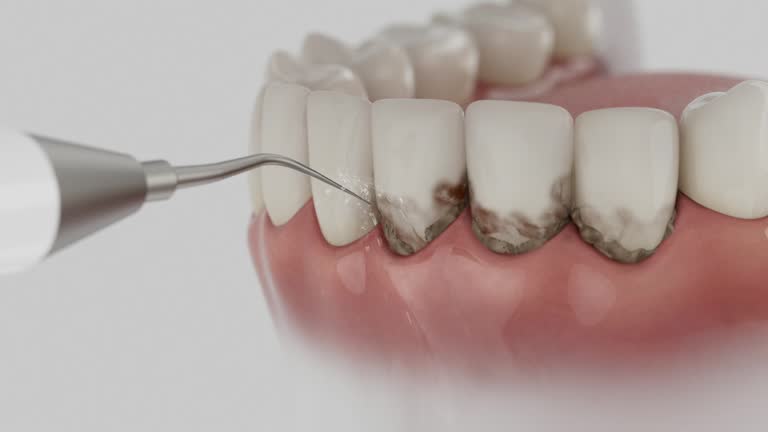 Reliable Dental Implants contractor in Montezuma, IA by Smile Center Dentistry
